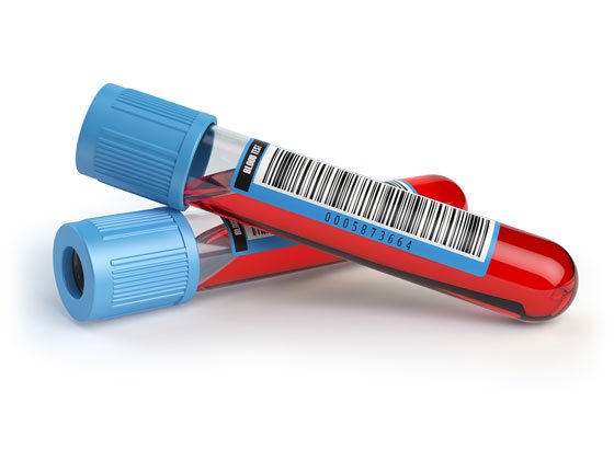 Correctly Labelled Barcoded Blood Sample Tube For Analysis